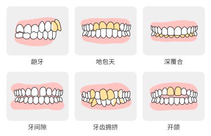 保定牙齿矫正的费用 2023年保定成人矫牙补贴标准是多少